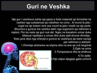 Guri ne Veshka
Nje gur i veshkave eshte nje pjese e forte materiali qe formohet ne
veshke nga substancat qe ndodhen ne urine . Ai mund te jete i
vogel sa nje kokerr rere ose mund te jete i madh sa nje perle.
Shumica e gureve tne veshka dalin nga organizmi pa ndihmen e
mjekut. Por ka raste qe guri nuk del. Ngec ne kanalinm urinar duke
bllokuar rrjedhjen e urines dhe duke sjell shume dhimbje..
Keto jane disa nga shenjat e gureve te veshkave qe kane nevoje
per ndihmen e doktorit
1.Dhimbje ekstreme ne shpine dhe ne ane qe nuk largohet
2.Gjak ne urina
3.Temperature dhe te dridhura
4.Te vjella
5.Nje ndjesi djegjeje gjate urinimit
 