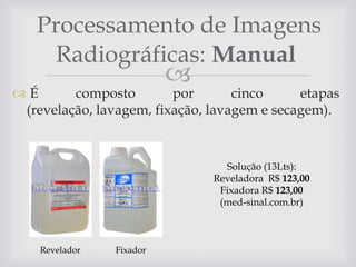 Processamento de Imagens
Radiográficas: Manual



É
composto
por
cinco
etapas
(revelação, lavagem, fixação, lavagem e secagem).

Solução (13Lts):
Reveladora R$ 123,00
Fixadora R$ 123,00
(med-sinal.com.br)

Revelador

Fixador

 