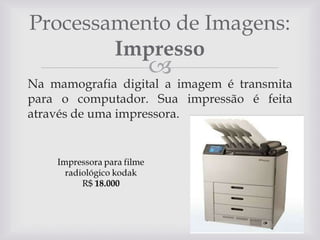 Processamento de Imagens:
Impresso



Na mamografia digital a imagem é transmita
para o computador. Sua impressão é feita
através de uma impressora.

 