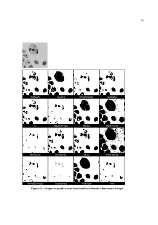 79




Figura 41 – Imagem original e a suas limiarizalções utilizando a ferramenta ImageJ
 