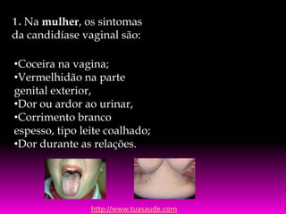 1. Na mulher, os sintomas
da candidíase vaginal são:
•Coceira na vagina;
•Vermelhidão na parte
genital exterior,
•Dor ou ardor ao urinar,
•Corrimento branco
espesso, tipo leite coalhado;
•Dor durante as relações.

http://www.tuasaude.com

 