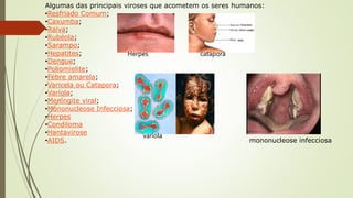 Algumas das principais viroses que acometem os seres humanos:
•Resfriado Comum;
•Caxumba;
•Raiva;
•Rubéola;
•Sarampo;
•Hepatites;
•Dengue;
•Poliomielite;
•Febre amarela;
•Varicela ou Catapora;
•Varíola;
•Meningite viral;
•Mononucleose Infecciosa;
•Herpes
•Condiloma
•Hantavirose
•AIDS. mononucleose infecciosa
Herpes catapora
varíola
 