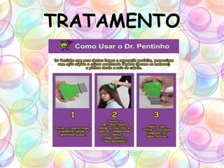 TRATAMENTO
 