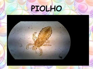 PIOLHO
 