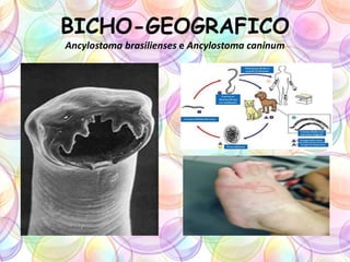 BICHO-GEOGRAFICO
Ancylostoma brasilienses e Ancylostoma caninum
 