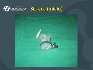Sitracc (inicio) 