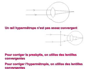 Pour corriger la presbytie, on utilise des lentilles convergentes  Pour corriger l’hypermétropie, on utilise des lentilles convergentes Un œil hypermétrope n’est pas assez convergent  