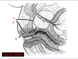 1 2 3 Vias de acesso 