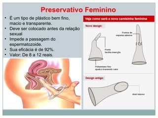 Preservativo Feminino
• É um tipo de plástico bem fino,
  macio e transparente.
• Deve ser colocado antes da relação
  sexual
• Impede a passagem do
  espermatozoide.
• Sua eficácia é de 92%.
• Valor: De 8 a 12 reais.
 