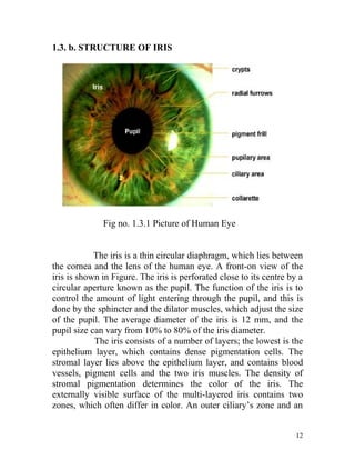 1.3. b. STRUCTURE OF IRIS




              Fig no. 1.3.1 Picture of Human Eye


            The iris is a thin circular diaphragm, which lies between
the cornea and the lens of the human eye. A front-on view of the
iris is shown in Figure. The iris is perforated close to its centre by a
circular aperture known as the pupil. The function of the iris is to
control the amount of light entering through the pupil, and this is
done by the sphincter and the dilator muscles, which adjust the size
of the pupil. The average diameter of the iris is 12 mm, and the
pupil size can vary from 10% to 80% of the iris diameter.
            The iris consists of a number of layers; the lowest is the
epithelium layer, which contains dense pigmentation cells. The
stromal layer lies above the epithelium layer, and contains blood
vessels, pigment cells and the two iris muscles. The density of
stromal pigmentation determines the color of the iris. The
externally visible surface of the multi-layered iris contains two
zones, which often differ in color. An outer ciliary’s zone and an


                                                                     12
 