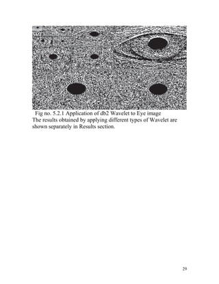 Fig no. 5.2.1 Application of db2 Wavelet to Eye image
The results obtained by applying different types of Wavelet are
shown separately in Results section.




                                                                  29
 
