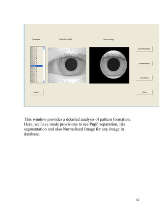 This window provides a detailed analysis of pattern formation.
Here, we have made provisions to see Pupil separation, Iris
segmentation and also Normalized Image for any image in
database.




                                                                 42
 