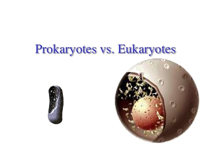 eukaryotes vs prokaryotes