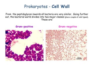 From the peptidoglycan inwards all bacteria are very similar. Going further
out, the bacterial world divides into two major classes (plus a couple of odd types).
These are:
Gram-positive Gram-negative
Prokaryotes - Cell Wall
 
