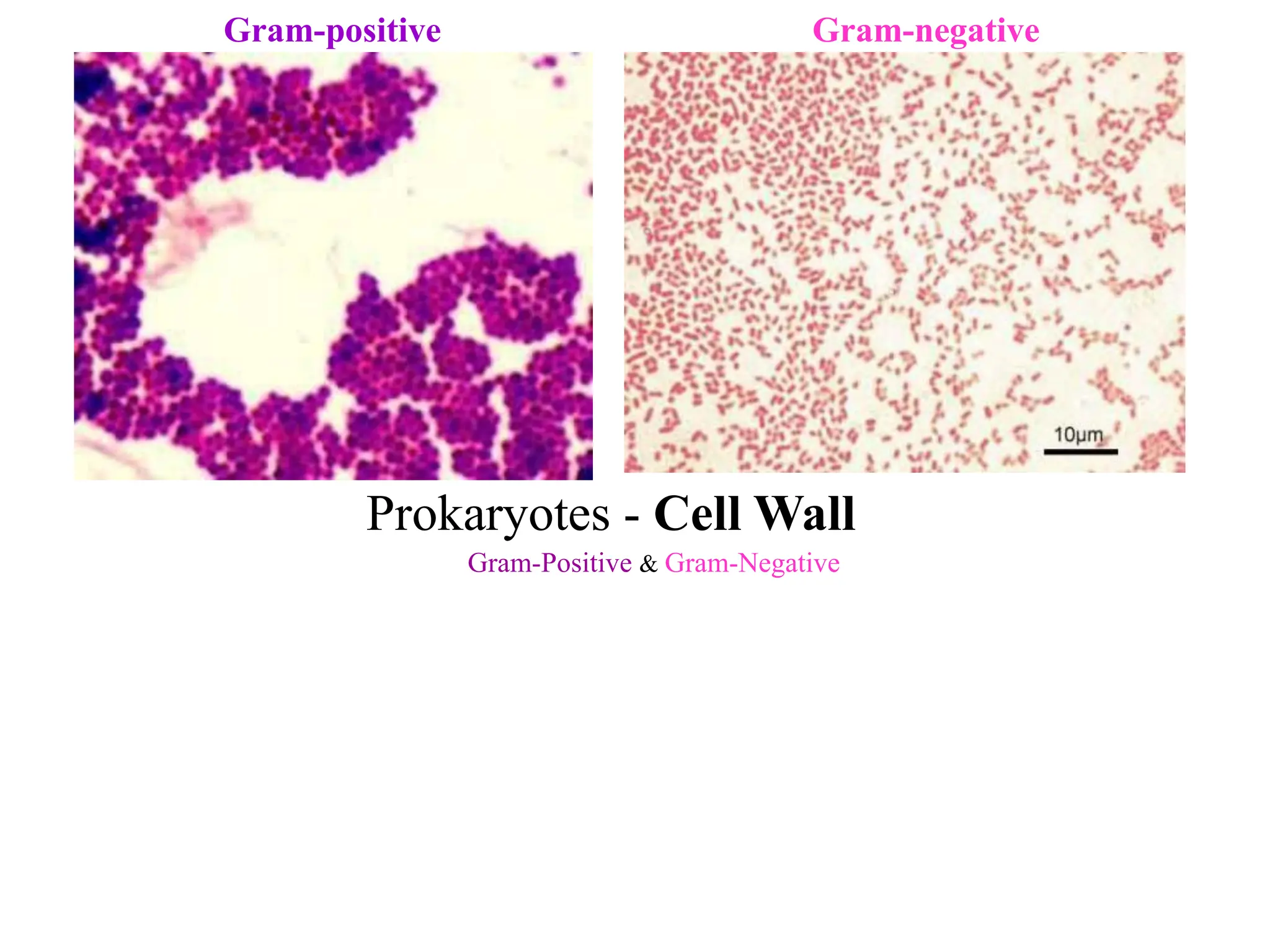 Gram-positive Gram-negative
Prokaryotes - Cell Wall
Gram-Positive & Gram-Negative
 