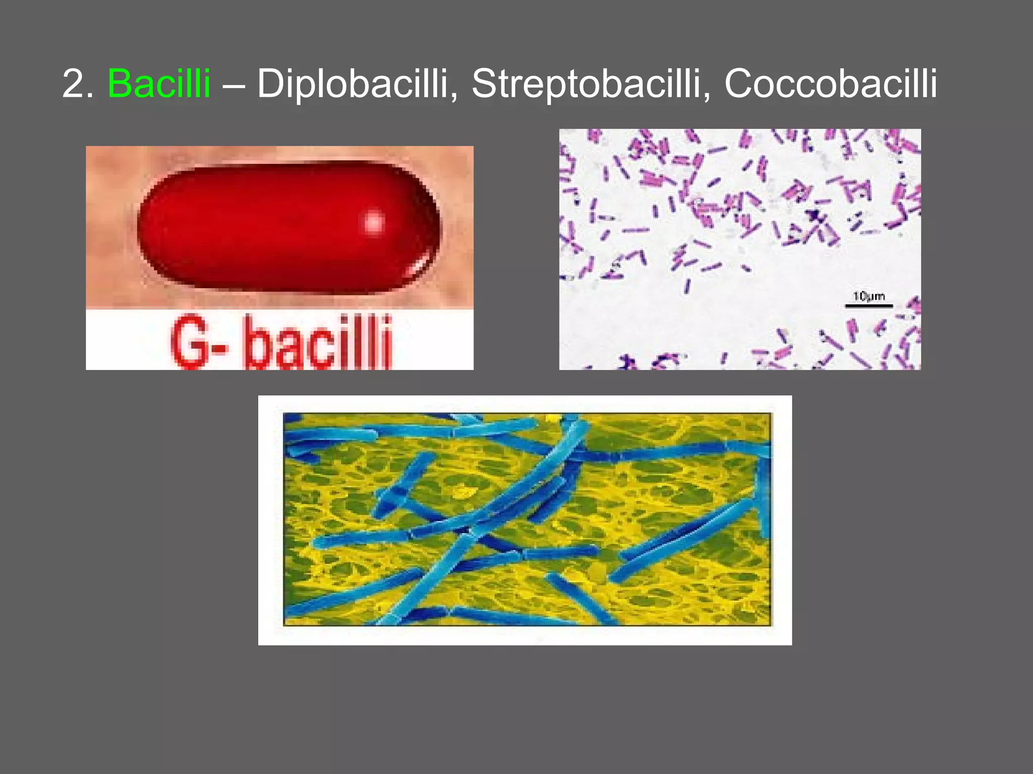 2. Bacilli – Diplobacilli, Streptobacilli, Coccobacilli
 