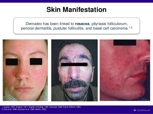 Mites - Veterinary Medicine 5410 with Bowman at Cornell ...