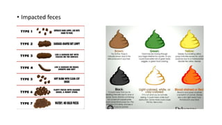 • Impacted feces
 