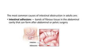 The most common causes of intestinal obstruction in adults are:
• Intestinal adhesions — bands of fibrous tissue in the abdominal
cavity that can form after abdominal or pelvic surgery
 