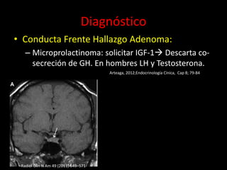Diagnóstico
• Conducta Frente Hallazgo Adenoma:
– Microprolactinoma: solicitar IGF-1 Descarta co-
secreción de GH. En hombres LH y Testosterona.
Arteaga, 2012;Endocrinología Cínica, Cap 8; 79-84
Radiol Clin N Am 49 (2011) 549–571
 