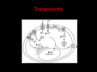 Tratamiento
 