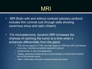 MRI
• MRI Brain with and without contrast (pituitary protocol
includes thin coronal cuts through sella showing
cavernous sinus and optic chiasm)
• For microadenoma, dynamic MRI increases the
chances of catching the tumor at a time when it
enhances differentially from the gland
• 75% are low signal on T1WI, and high signal on T2WI (but 25% can behave
in any way, including completely opposite to above).
• Enhancement is very time-dependent.
• Initially, gadolinium enhances the normal pituitary (no blood brain barrier)
but not the pituitary tumor.
• After ≈ 30minutes, the tumor enhances about the same.
 