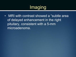 Imaging
• MRI with contrast showed a “subtle area
of delayed enhancement in the right
pituitary, consistent with a 5-mm
microadenoma.
 