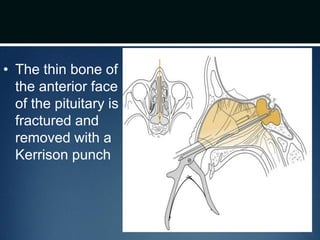 • The thin bone of
the anterior face
of the pituitary is
fractured and
removed with a
Kerrison punch
drdhiru456@gmail.com
 
