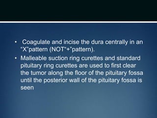 • Coagulate and incise the dura centrally in an
“X”pattern (NOT“+”pattern).
• Malleable suction ring curettes and standard
pituitary ring curettes are used to first clear
the tumor along the floor of the pituitary fossa
until the posterior wall of the pituitary fossa is
seen
 