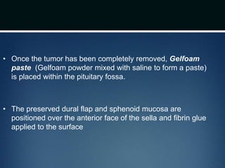 • Once the tumor has been completely removed, Gelfoam
paste (Gelfoam powder mixed with saline to form a paste)
is placed within the pituitary fossa.
• The preserved dural flap and sphenoid mucosa are
positioned over the anterior face of the sella and fibrin glue
applied to the surface
 