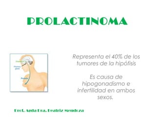 PROLACTINOMA
Representa el 40% de los
tumores de la hipófisis
Es causa de
hipogonadismo e
infertilidad en ambos
sexos.
Prof. Agda Dra. Beatriz Mendoza
 