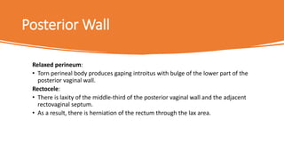 Prolapse | PPTX