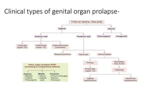 Clinical types of genital organ prolapse-
 