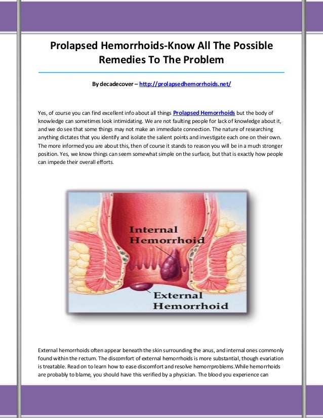 Prolapsed hemorrhoids