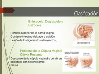 Clasificación
Enterocele, Duglascele o
Elitrocele
 Porción superior de la pared vaginal
 Contiene intestino delgado o epiplón
 Lesión de los ligamentos uterosacros
Prolapso de la Cúpula Vaginal o
Cérvix Restante
 Descenso de la cúpula vaginal o cérvix en
pacientes con histerectomía
previa
 