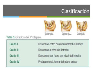 Clasificación
 
