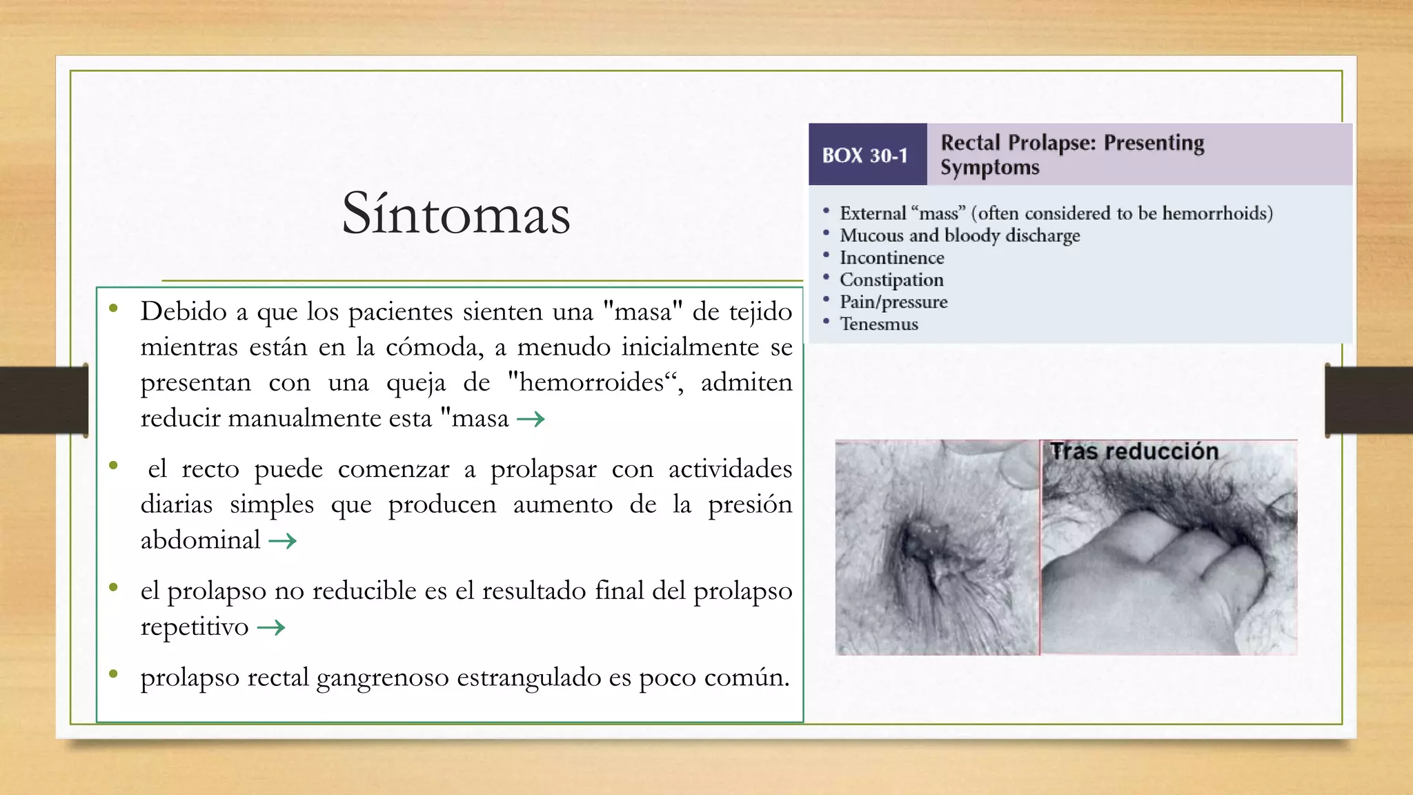 Prolapso rectal | PPTX | Digestive Disorders | Diseases and Conditions