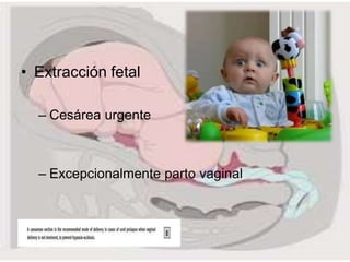 • Extracción fetal
– Cesárea urgente
– Excepcionalmente parto vaginal