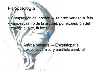 Fisiopatología 
• Compresión del cordón→↓retorno venoso al feto 
• Vasoespasmo de la art umb por exposición del 
cordón al aire, fluidos.. 
Asfixia perinatal→ Encefalopatía 
hipoxicoisquémica y parálisis cerebral 
 
