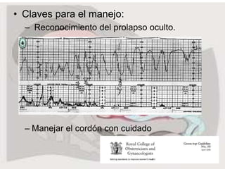 • Claves para el manejo:
– Reconocimiento del prolapso oculto.
– Manejar el cordón con cuidado