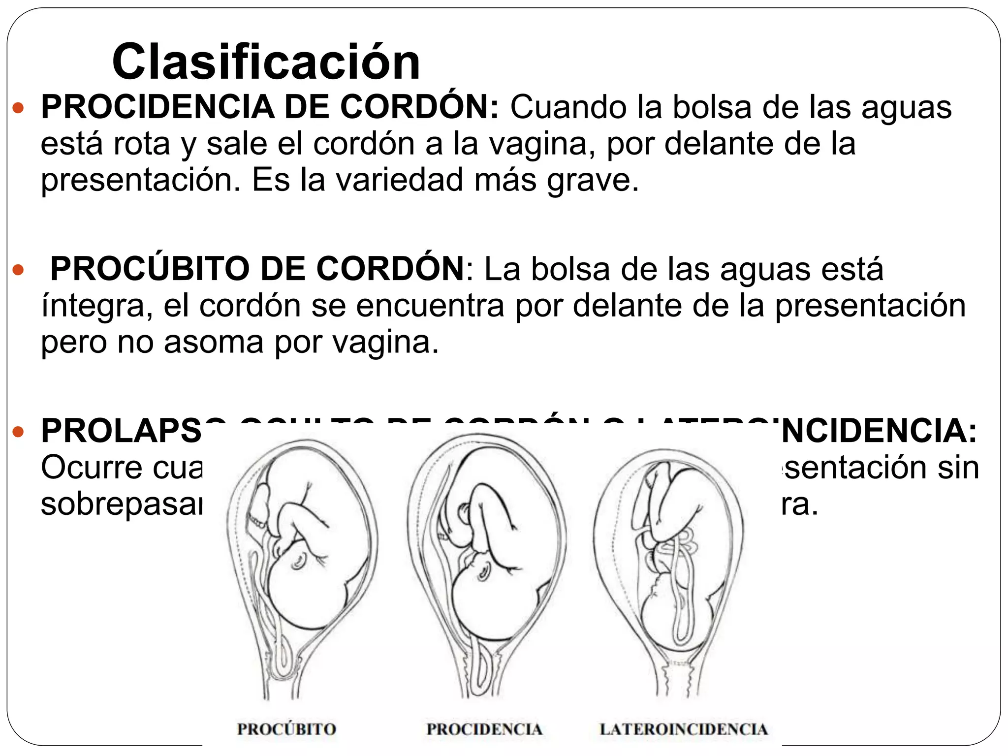Prolapso de cordon umbilical PPT