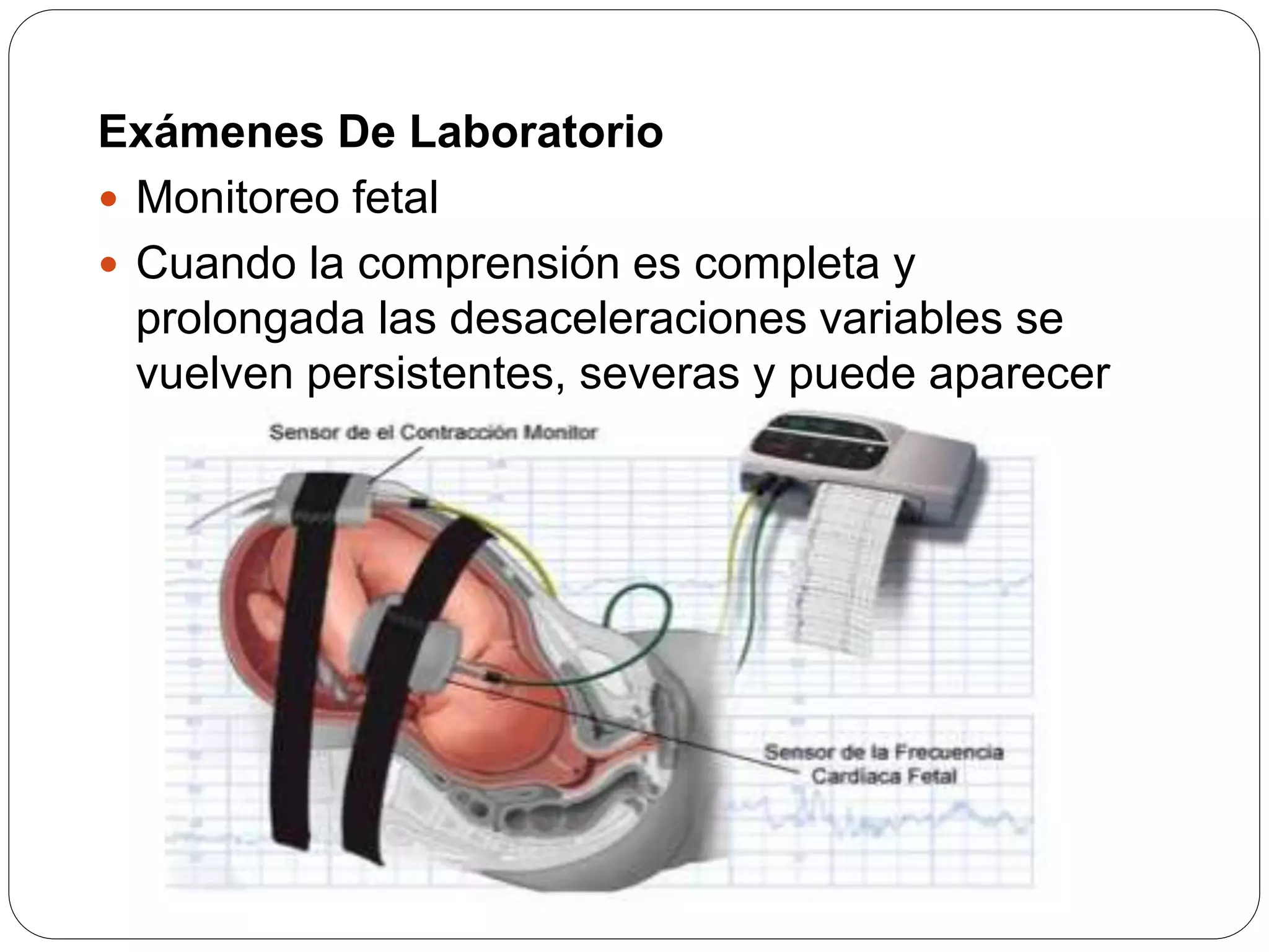 Prolapso de cordon umbilical PPT