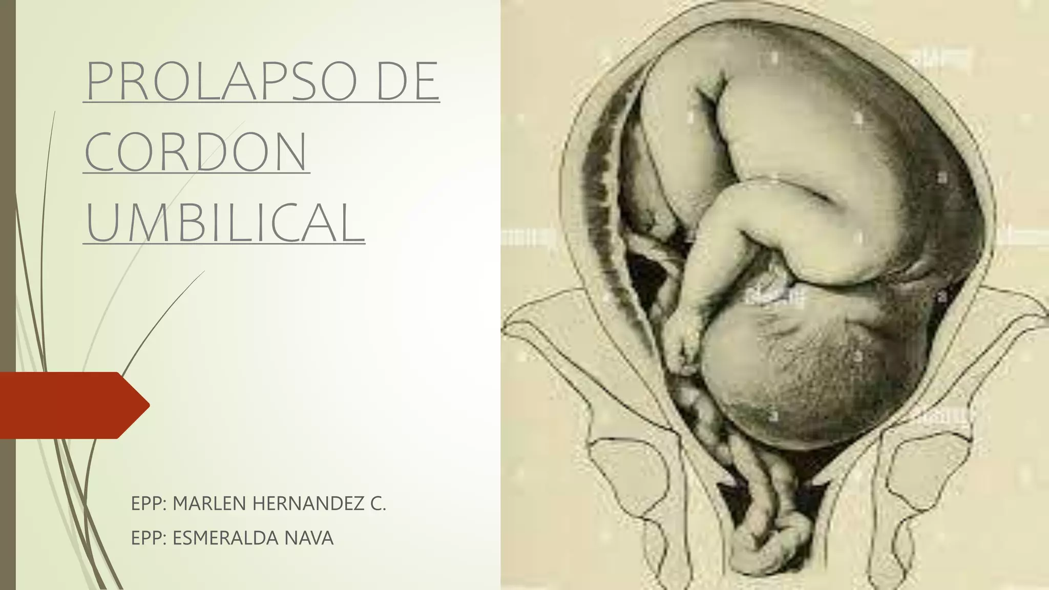 PROLAPSO DE CORDON UMBILICAL.pptx
