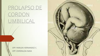 PROLAPSO DE
CORDON
UMBILICAL
EPP: MARLEN HERNANDEZ C.
EPP: ESMERALDA NAVA
 