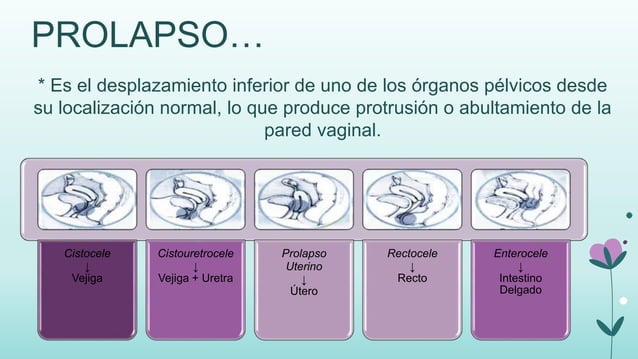 Prolapso De Organos Pelvicos Gpc