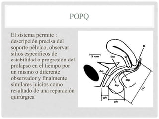 POPQ
El sistema permite :
descripción precisa del
soporte pélvico, observar
sitios específicos de
estabilidad o progresión del
prolapso en el tiempo por
un mismo o diferente
observador y finalmente
similares juicios como
resultado de una reparación
quirúrgica
 
