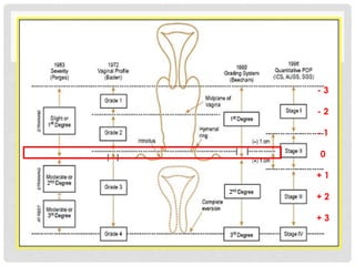 - 3
- 2
- 1
0
+ 1
+ 2
+ 3
 