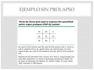 EJEMPLO SIN PROLAPSO
 