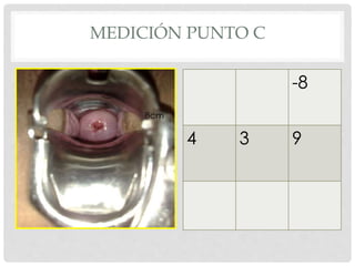 8cm
-8
4 3 9
MEDICIÓN PUNTO C
 