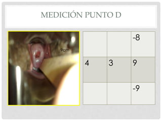 9cm
-8
4 3 9
-9
MEDICIÓN PUNTO D
 